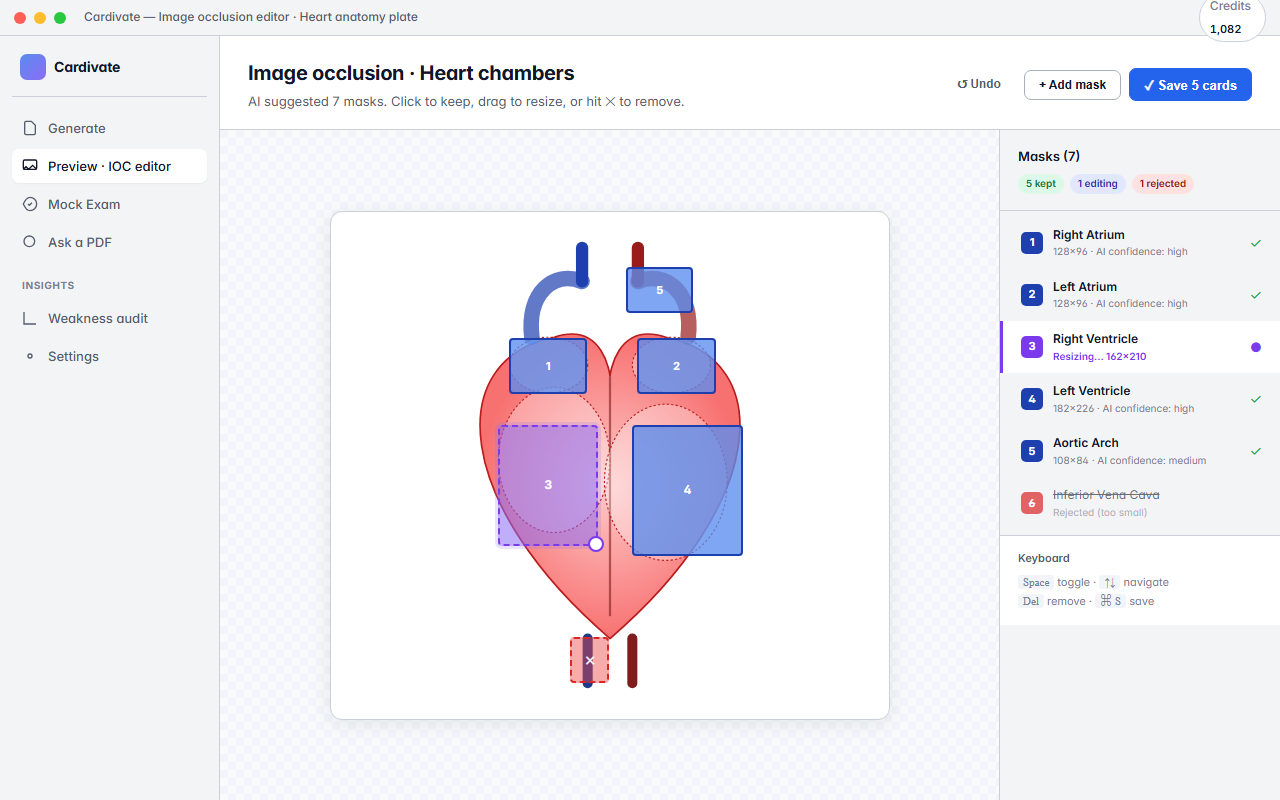 Image occlusion view — Cardivate suggests masks on a radiology figure; you keep or tweak each one.